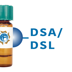 Datura stramonium Lectin (DSA/DSL) - Separopore&reg; 4B